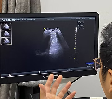 Imbasan Ultrasound